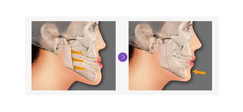 �ذ���ǰ��Ա�