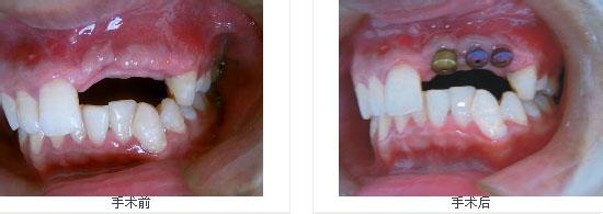 ����ȱʧԭ��,����ȱʧ��ֲ���޸�