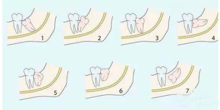 �ξ�ͷ������Ǯ