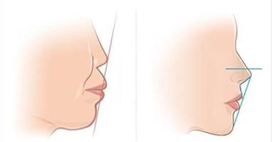 ���������ķ�������Щ�أ�