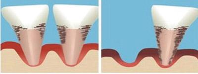 �����ɶ���ô��