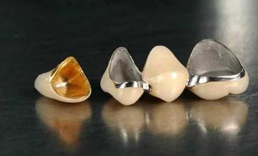 �������޸���Ҫ�೤ʱ�䣿