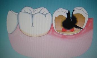 �����ж�