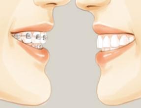 �������ݽ���,��������ע������