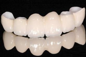 ���������϶�����Щ?