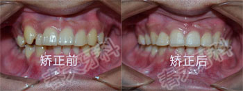 ���ݽ���������