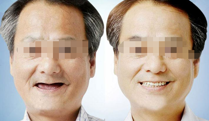 ����������ֲ������һ����һ��,��ֲ����һ����һ�Ż