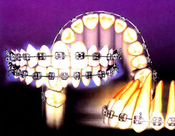 ����ѡ���ַ����������,������������,MBT������������