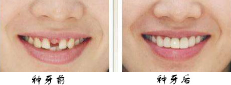 ��ֲ������Щ����,��ֲ������