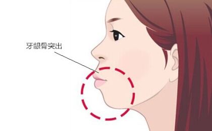 ������ͻ��ô�γɵ�,������ͻ�γɵ�ԭ��