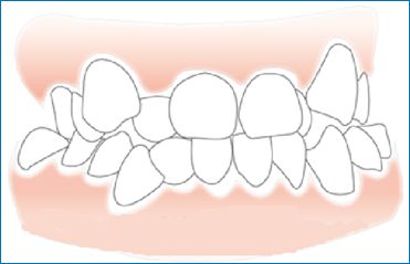 ����ӵ��������������,����ӵ����������