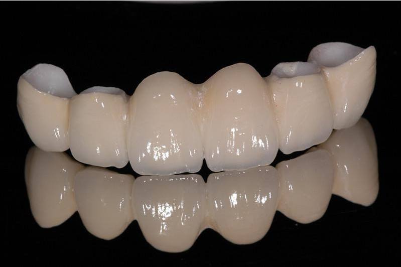 ������������ô��,������ʧ����ô��