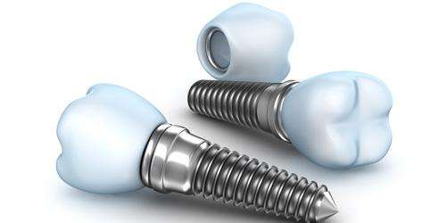 ��ֲ��ǰ��Ҫ����Щ׼��,��ֲ������ǰ׼��