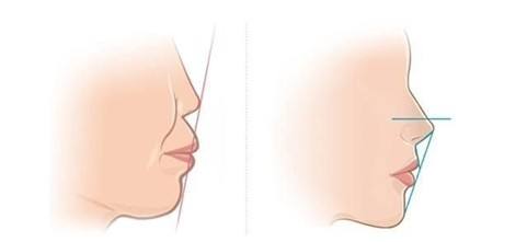 ��ǰ������ǰͻ��ԭ��,����ǰͻ��ԭ��