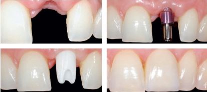 ��ֲ��������һ����,��ֲ���������Ա�