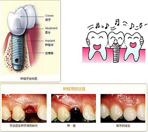 ��ֲ��ʧ�ܵ���Ҫԭ��,��ֲ��ʧ��ԭ��
